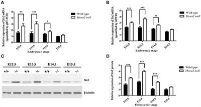 Six2 Plays an Intrinsic Role in Regulating Proliferation of Mesenchymal Cells in the Developing Palate